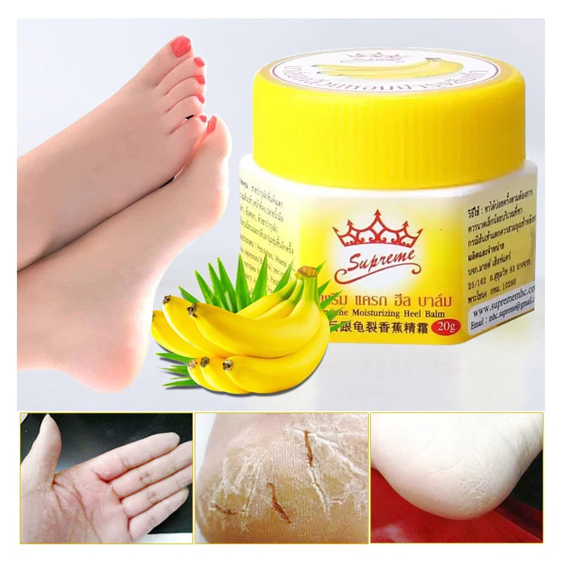 cream for cracked feet and hands